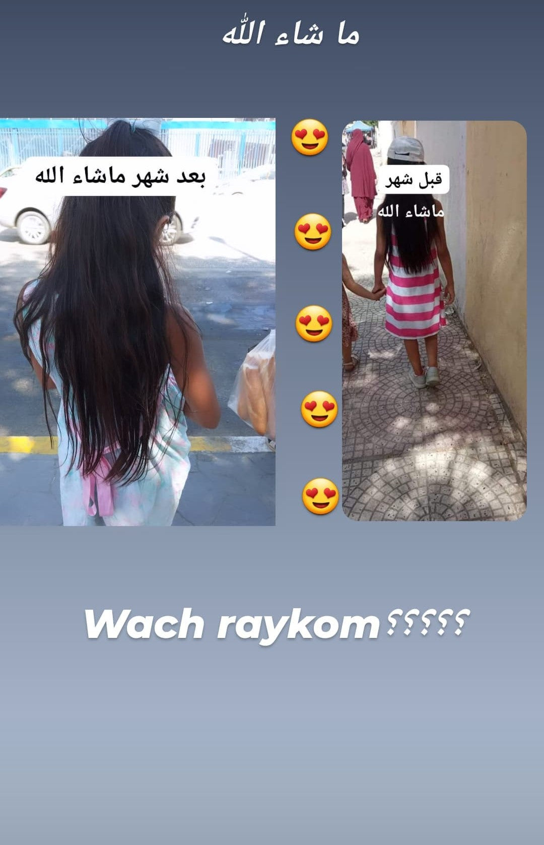 أحسن زيت طبيعي لمشاكل الشعر