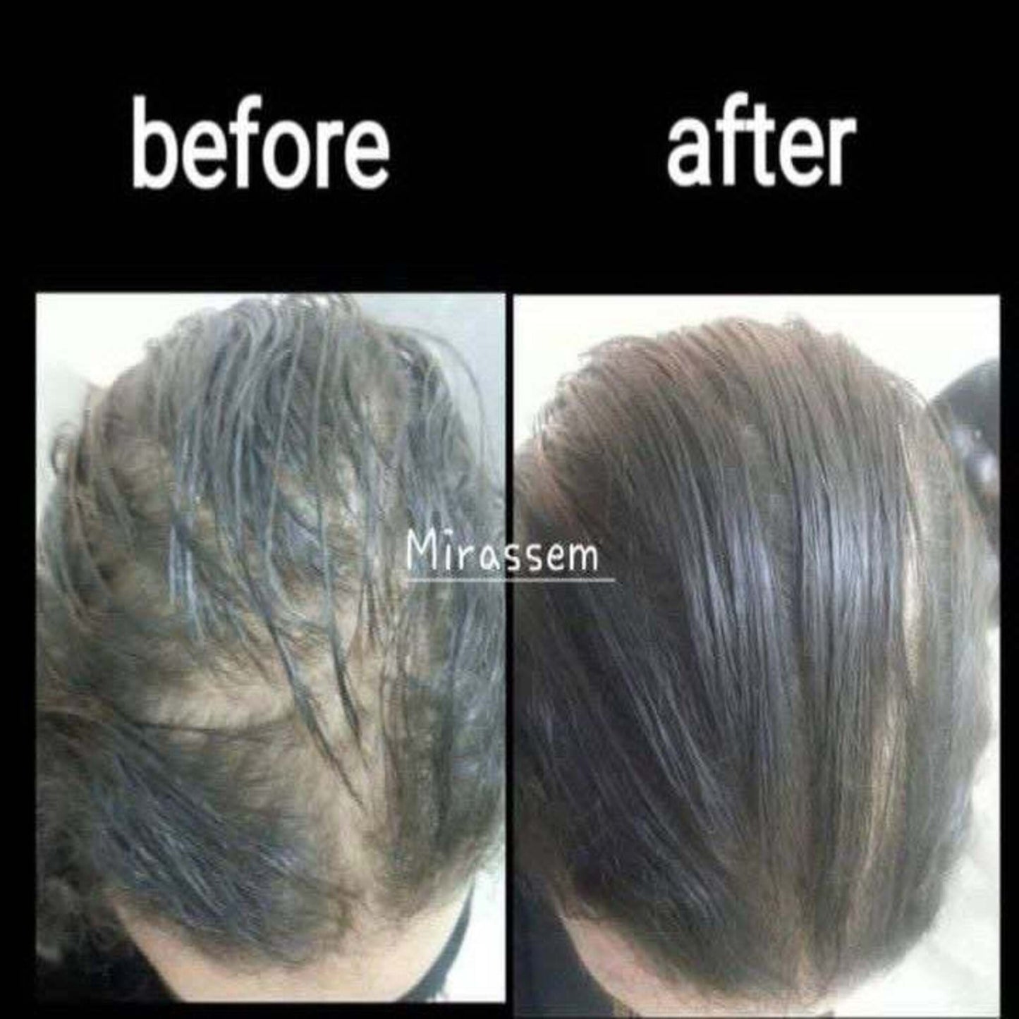 أحسن زيت طبيعي لمشاكل الشعر